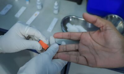 Mais de 26 mil exames de malária são realizados em 2026 e rede reforça atendimento